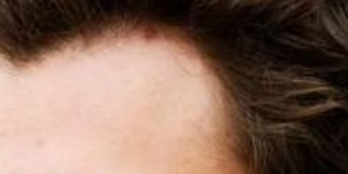 Roofterrace: Okain (FR), Collins & Behnam, Roofio, Yvel & Tristan